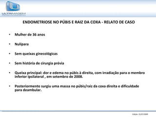 ENDOMETRIOSE NO PÚBIS E RAIZ DA COXA - RELATO DE CASO Mulher de 36 anos Nulípara Sem queixas ginecológicas Sem história de cirurgia prévia Queixa principal: dor e edema no púbis à direita, com irradiação para o membro inferior ipsilateral , em setembro de 2008. Posteriormente surgiu uma massa no púbis/raiz da coxa direita e dificuldade para deambular. 