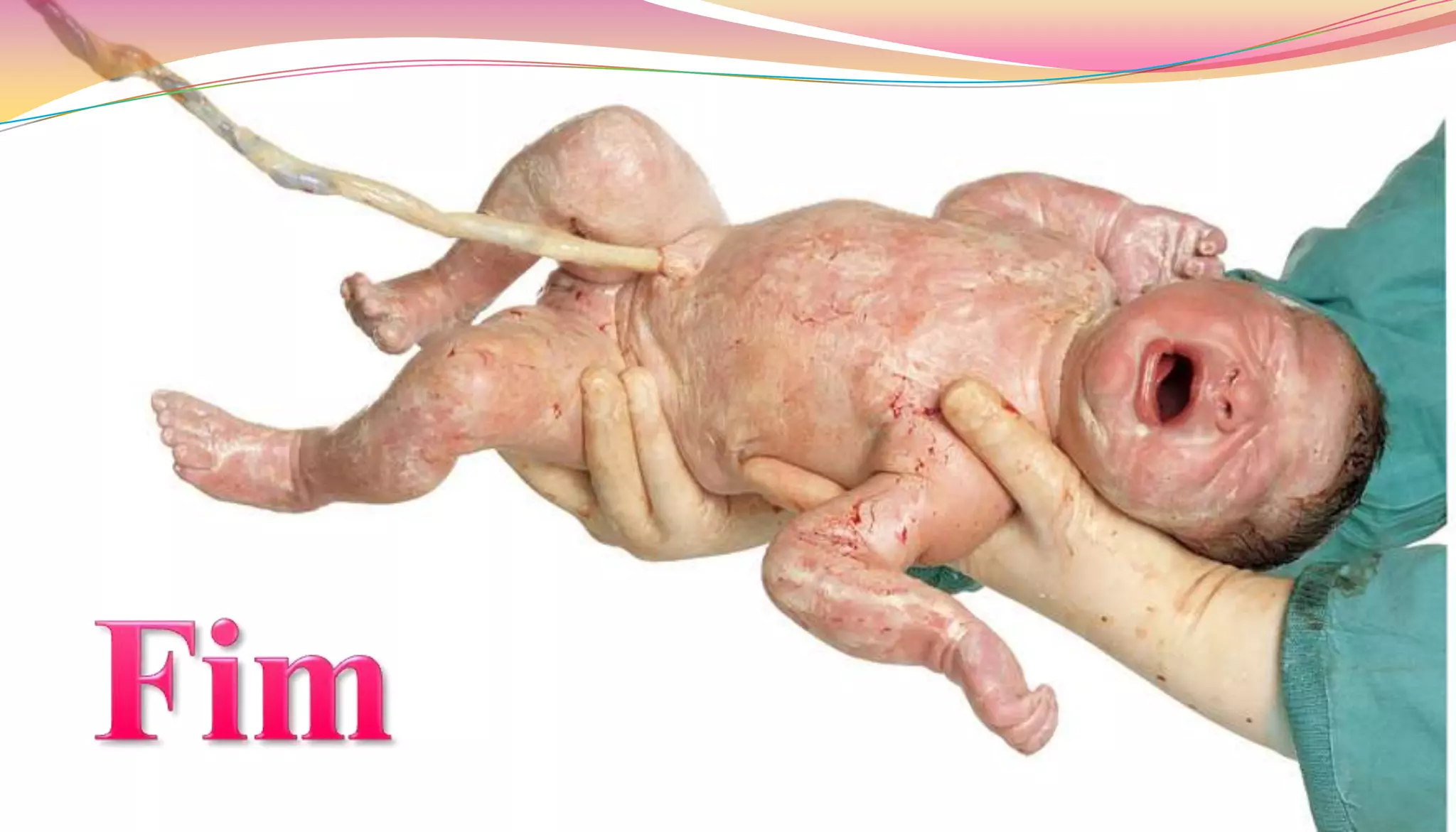 Desenvolvimento pré natal