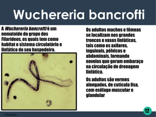 Wuchereria bancrofti   
A Wuchereria bancrofti é um
nematoide do grupo dos
Filarídeos, os quais tem como
habitat o sistema circulatório e
linfático do seu hospedeiro.
Os adultos machos e fêmeas
se localizam nos grandes
troncos e vasos linfáticos,
tais como os axilares,
inguinais, pélvicos e
abdominais, formando
novelos que geram embaraço
na circulação de drenagem
linfática.
Os adultos são vermes
alongados, de cutícula lisa,
com esôfago muscular e
glandular
12
Gustavo
 