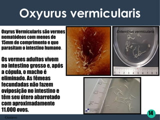 Oxyurus vermicularis
Oxyrus Vermicularis são vermes
nematódeos com menos de
15mm de comprimento e que
parasitam o intestino humano.
Os vermes adultos vivem
no intestino grosso e, após
a cópula, o macho é
eliminado. As fêmeas
fecundadas não fazem
oviposição no intestino e
têm seu útero abarrotado
com aproximadamente
11.000 ovos.
14
Gustavo
Enterobius vermicularis
 