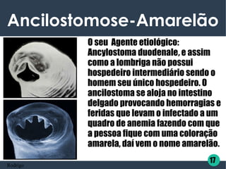 Ancilostomose-Amarelão
O seu  Agente etiológico:
Ancylostoma duodenale, e assim
como a lombriga não possui
hospedeiro intermediário sendo o
homem seu único hospedeiro. O
ancilostoma se aloja no intestino
delgado provocando hemorragias e
feridas que levam o infectado a um
quadro de anemia fazendo com que
a pessoa fique com uma coloração
amarela, daí vem o nome amarelão.
17
Rodrigo
 
