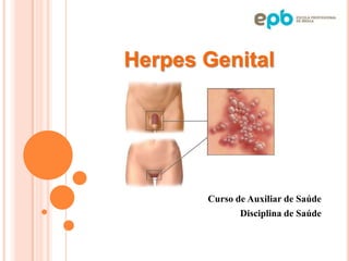 Herpes Genital




       Curso de Auxiliar de Saúde
              Disciplina de Saúde
 