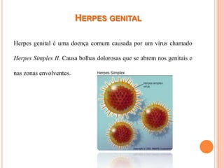 HERPES GENITAL

Herpes genital é uma doença comum causada por um vírus chamado

Herpes Simples II. Causa bolhas dolorosas que se abrem nos genitais e

nas zonas envolventes.
 