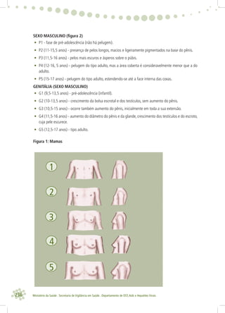 236 Ministério da Saúde . Secretaria de Vigilância em Saúde . Departamento de DST,Aids e Hepatites Virais
1
2
4
5
3
SEXO MASCULINO (ﬁgura 2)
• P1 - fase de pré-adolescência (não há pelugem).
• P2 (11-15,5 anos) - presença de pelos longos, macios e ligeiramente pigmentados na base do pênis.
• P3 (11,5-16 anos) - pelos mais escuros e ásperos sobre o púbis.
• P4 (12-16, 5 anos) - pelugem do tipo adulto, mas a área coberta é consideravelmente menor que a do
adulto.
• P5 (15-17 anos) - pelugem do tipo adulto, estendendo-se até a face interna das coxas.
GENITÁLIA (SEXO MASCULINO)
• G1 (9,5-13,5 anos) - pré-adolescência (infantil).
• G2 (10-13,5 anos) - crescimento da bolsa escrotal e dos testículos, sem aumento do pênis.
• G3 (10,5-15 anos) - ocorre também aumento do pênis, inicialmente em toda a sua extensão.
• G4 (11,5-16 anos) - aumento do diâmetro do pênis e da glande, crescimento dos testículos e do escroto,
cuja pele escurece.
• G5 (12,5-17 anos) - tipo adulto.
Figura 1: Mamas
 