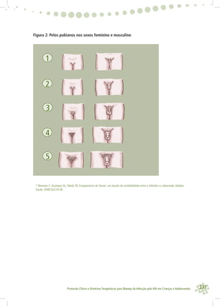 237Protocolo Clínico e Diretrizes Terapêuticas para Manejo da Infecção pelo HIV em Crianças e Adolescentes
* Meneses C, Ocampos DL,Toledo TB. Estagiamento de Tanner: um estudo de conﬁabilidade entre o referido e o observado.Adolesc
Saude. 2008;5(3):54-56
1
2
4
5
3
Figura 2: Pelos pubianos nos sexos feminino e masculino
 