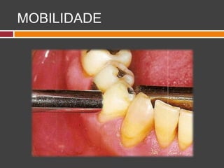 MOBILIDADE
 