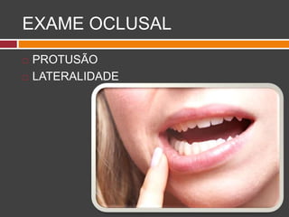 EXAME OCLUSAL
 PROTUSÃO
 LATERALIDADE
 