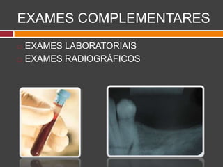 EXAMES COMPLEMENTARES
 EXAMES LABORATORIAIS
 EXAMES RADIOGRÁFICOS
 