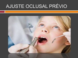 AJUSTE OCLUSAL PRÉVIO
 