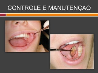 CONTROLE E MANUTENÇAO
 