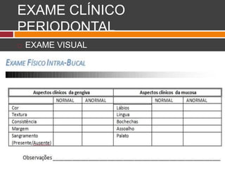 EXAME CLÍNICO
PERIODONTAL
 EXAME VISUAL
 