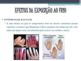 • FENÔMENO DE RAYNAUD
▫ É uma doença na qual as temperaturas frias ou estresse emocional causam
espasmos vasculares que bloqueiam o fluxo sanguíneo dos dedos dos pés e das
mãos (em alguns casos este distúrbio pode ocorrer nas orelhas e nariz).
EFEITOS DA EXPOSIÇÃO AO FRIO
 