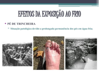 • PÉ DE TRINCHEIRA
▫ Situação patológica devido a prolongada permanência dos pés em água fria;
EFEITOS DA EXPOSIÇÃO AO FRIO
 