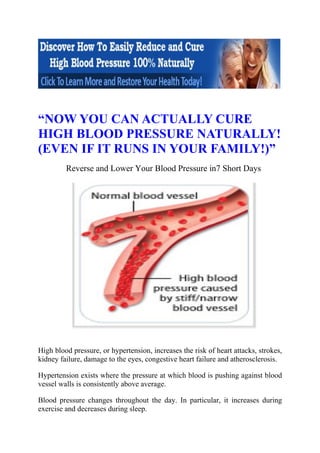 “NOW YOU CAN ACTUALLY CURE
HIGH BLOOD PRESSURE NATURALLY!
(EVEN IF IT RUNS IN YOUR FAMILY!)”
         Reverse and Lower Your Blood Pressure in7 Short Days




High blood pressure, or hypertension, increases the risk of heart attacks, strokes,
kidney failure, damage to the eyes, congestive heart failure and atherosclerosis.

Hypertension exists where the pressure at which blood is pushing against blood
vessel walls is consistently above average.

Blood pressure changes throughout the day. In particular, it increases during
exercise and decreases during sleep.
 
