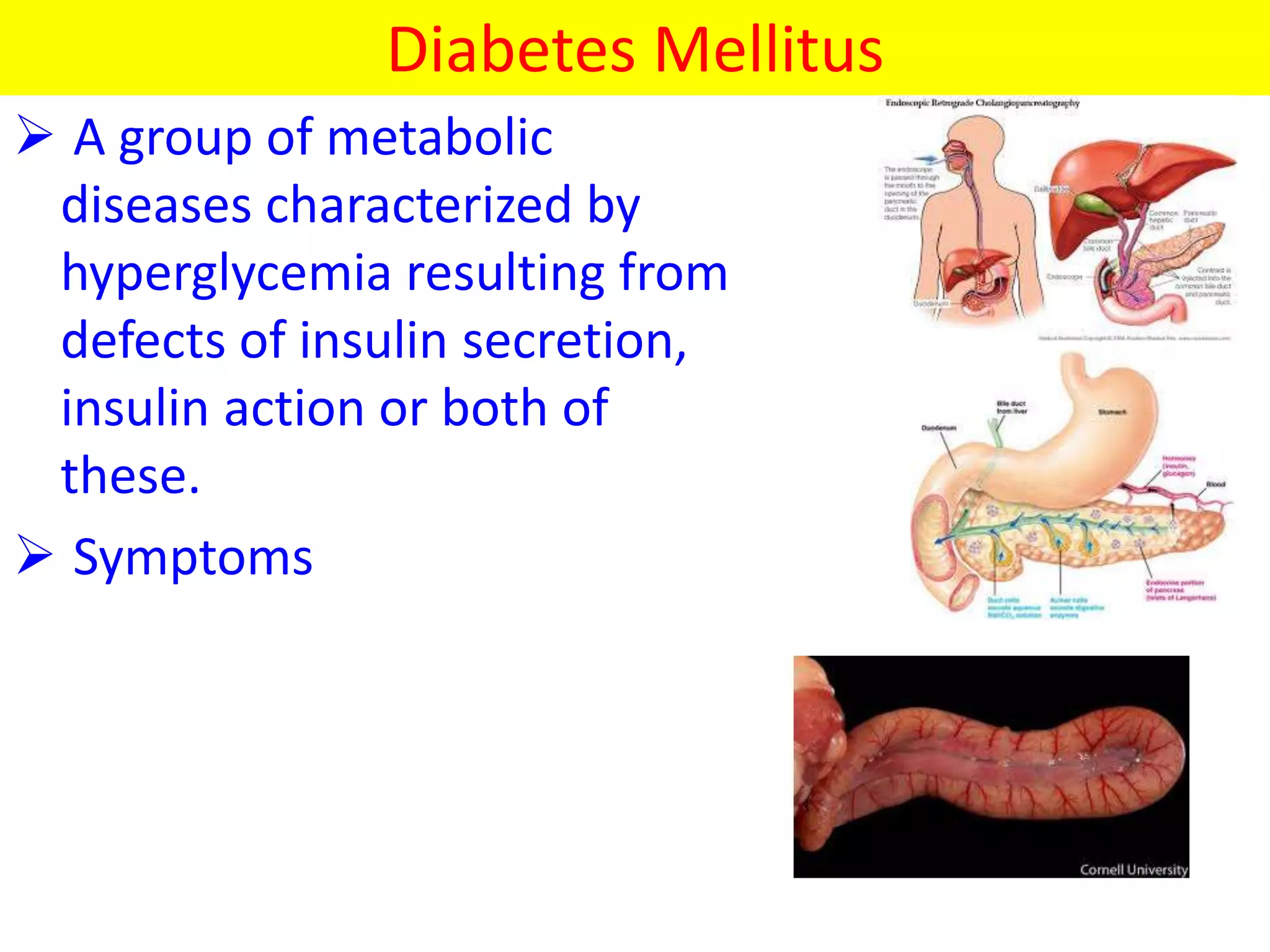 Diabetes Mellitus
 A group of metabolic
diseases characterized by
hyperglycemia resulting from
defects of insulin secretion,
insulin action or both of
these.
 Symptoms
 