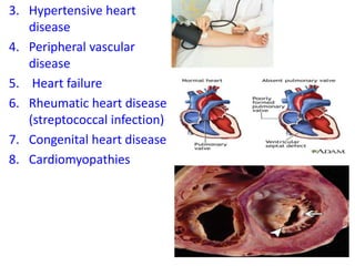 3. Hypertensive heart
disease
4. Peripheral vascular
disease
5. Heart failure
6. Rheumatic heart disease
(streptococcal infection)
7. Congenital heart disease
8. Cardiomyopathies
 