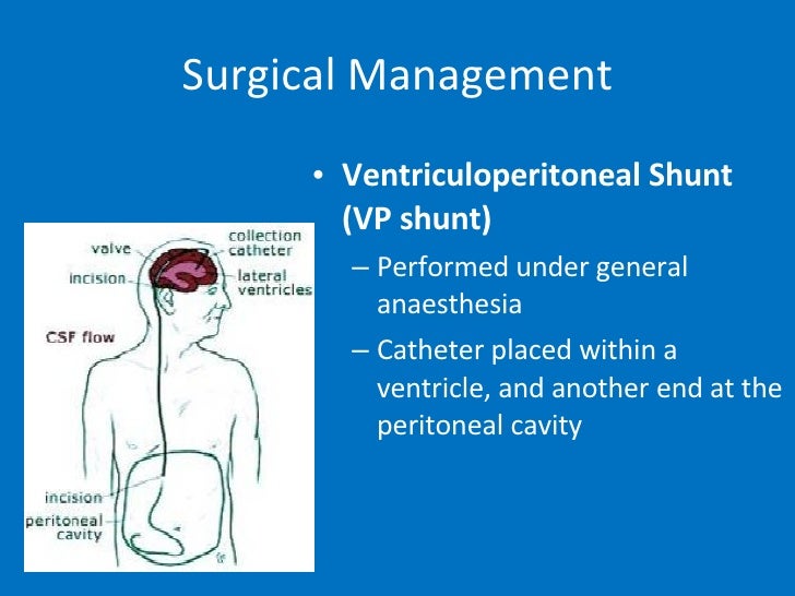 Normal Pressure Hydrocephalus