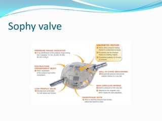 Sophy valve

 