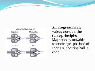 All programmable
valves work on the
same principle:
Magnetically movable
rotor changes pre-load of
spring supporting ball in
cone

 
