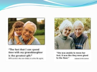 Normal Pressure Hydrocephalus