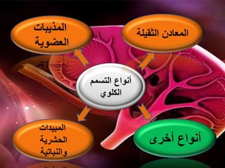 ‫التسمم‬ ‫أنواع‬
‫الكلوي‬
‫أخرى‬ ‫أنواع‬
‫الثقي‬ ‫المعادن‬‫لة‬
‫المبيدات‬
‫الحشرية‬
‫والنباتية‬
‫المذيبات‬
‫العضوية‬
 