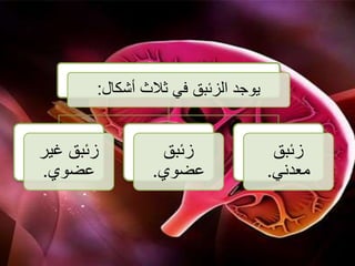 ‫أشكال‬ ‫ثالث‬ ‫في‬ ‫الزئبق‬ ‫يوجد‬:
‫غير‬ ‫زئبق‬
‫عضوي‬.
‫زئبق‬
‫عضوي‬.
‫زئبق‬
‫معدني‬.
 