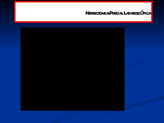 Nefrectomia Parcial Laparoscópica 