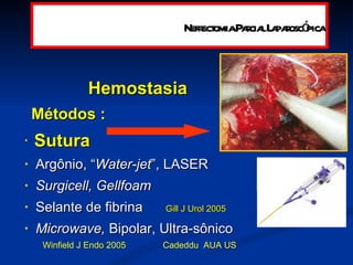 Hemostasia  Métodos :   Sutura Argônio, “ Water-jet ”, LASER Surgicell, Gellfoam   Selante de fibrina  Gill J Urol 2005 Microwave,  Bipolar, Ultra-sônico Winfield J Endo 2005  Cadeddu  AUA US Nefrectomia Parcial Laparoscópica 
