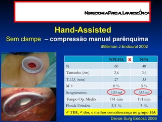 Hand-Assisted Sem clampe   –  compressão manual parênquima Stifelman J Endourol 2002 Devoe Surg Endosc 2008 X Nefrectomia Parcial Laparoscópica 5  % 3,3  % Fistula Urinária < TIH, < dor, e melhor convalescença no grupo HA NPLHA NPA N 60 40 Tamanho (cm) 2,6 2,6 T.I.Q. (min) 27 33 M + 0 % 5 % Sangramento 120 ml 353 ml Tempo Op. Médio 161 min 191 min 