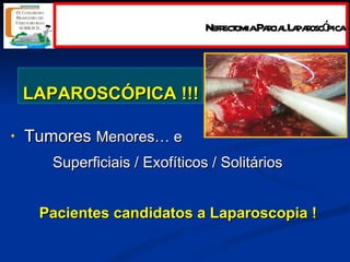 LAPAROSCÓPICA !!! Tumores  Menores… e  Superficiais /  Exofíticos / Solitários Pacientes candidatos a Laparoscopia ! Nefrectomia Parcial Laparoscópica 
