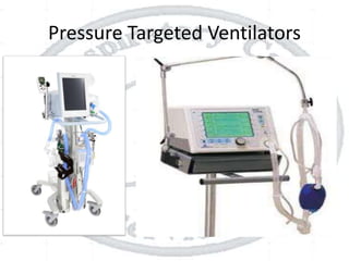 Pressure Targeted Ventilators
 