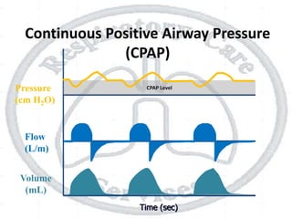 Time (sec)
Flow
(L/m)
Pressure
(cm H2O)
Volume
(mL)
CPAP Level
Continuous Positive Airway Pressure
(CPAP)
 