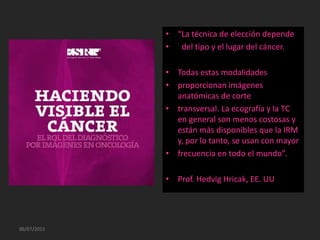 06/07/2015
• “La técnica de elección depende
• del tipo y el lugar del cáncer.
• Todas estas modalidades
• proporcionan imágenes
anatómicas de corte
• transversal. La ecografía y la TC
en general son menos costosas y
están más disponibles que la IRM
y, por lo tanto, se usan con mayor
• frecuencia en todo el mundo”.
• Prof. Hedvig Hricak, EE. UU
 