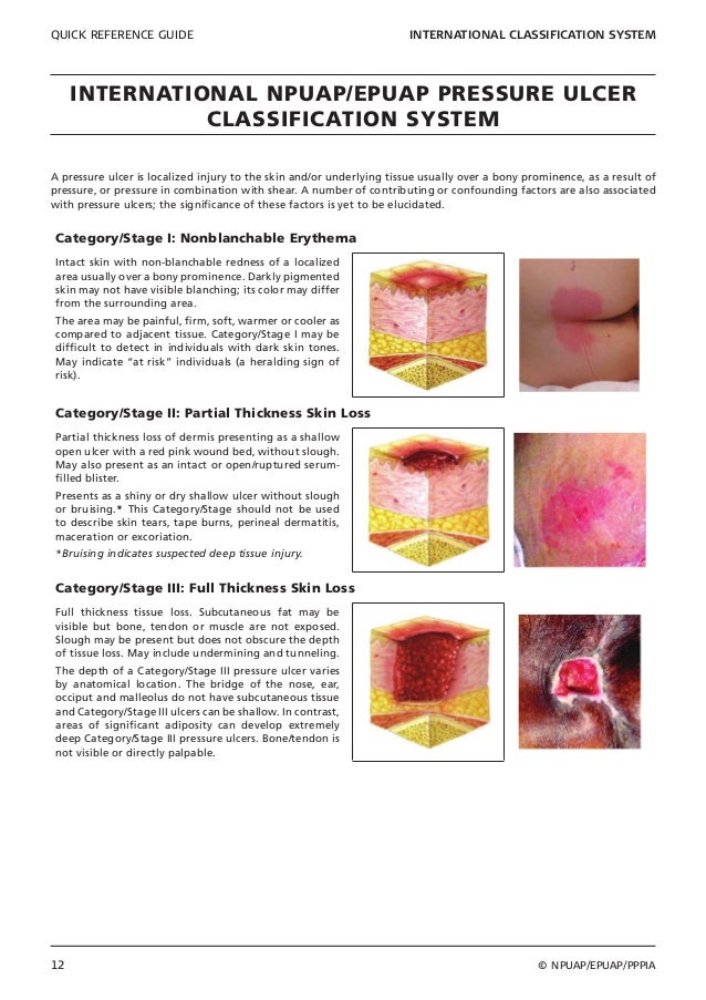 Npuap epuap-pppia-quick-reference-guide-2014