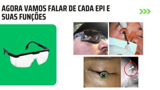 AGORA VAMOS FALAR DE CADA EPI E
SUAS FUNÇÕES
 