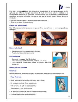 179
Este é um recurso extremo, pois geralmente causa danos ao tecido nas áreas onde for
aplicado, por falta de irrigação sangüínea. É muito importante avisar o médico ou o
socorrista da existência do torniquete e do horário em que foi aplicado. O torniquete só
deverá ser removido no hospital. Lembrar-se que apertar demais poderá destruir tecidos e
músculos.
- Utilizar somente quando a hemorragia não for controlada;
- Geralmente causa danos ao tecido.
Como fazer um torniquete:
São utilizados somente nos casos em que a vítima teve o braço ou perna amputada ou
esmagada.
Hemorragia Nasal
- Rompimento dos vasos sanguíneos do nariz;
- Pode indicar traumatismo craniano.
Procedimentos:
- Comprimir o nariz por 5 a 10 minutos;
- Colocar compressas frias no nariz, na testa e na nuca;
- E nos casos de inconsciência, deixar na posição lateral de
segurança.
Hemorragia nos Pulmões
Sintomas:
Manifesta-se após um acesso de tosse e o sangue que sai pela boca é vermelho vivo.
Procedimentos:
- Deitar a vitima com a cabeça mais baixa que o corpo;
- Se possível manter a vítima agasalhada;
- Colocar bolsa de gelo no local dolorido;
- Tranqüilizá-la e não deixa-la falar;
- Se necessário, reanimar (ver parada cardio-respiratória);
- Procurar auxilio médico imediatamente.
 