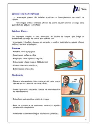 182
Conseqüência das Hemorragias
- Hemorragias graves não tratadas ocasionam o desenvolvimento do estado de
choque.
- Hemorragias lentas e crônicas (através de úlcera) causam anemia (ou seja, baixa
quantidade de glóbulos vermelhos).
Estado de Choque
Em linguagem simples, é uma diminuição do volume de sangue que chega às
extremidades do corpo. As causas mais comuns são:
Hemorragias, infecções, doenças do coração e cérebro, queimaduras graves, choque
elétrico, fraturas e amputações.
Sintomas:
- Pele fria, pálida e pegajosa;
- Suor intenso na face e mãos;
- Respiração curta, rápida ou irregular;
- Pulso rápido e fraco (mais de 100 bat./min.)
- Visão nublada e inconsciência;
- Extremidades arroxeadas;
Atendimento:
- Manter a vítima deitada, com a cabeça mais baixa que os
pés (exceto em casos de fratura de crânio);
- Sentir a pulsação, colocando 2 dedos na artéria radial ou
na artéria carótida;
- Pulso fraco pode significar estado de choque;
- Falta de pulsação e de movimento respiratório significa
parada cardio-respiratória;
- Verificar se existem hemorragias e controla-la (estancar);
 