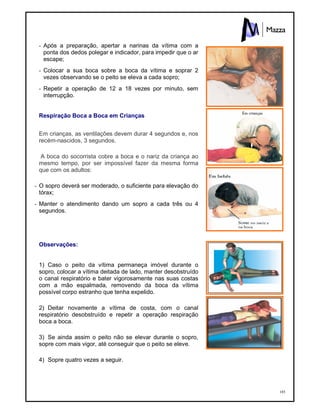 185
- Após a preparação, apertar a narinas da vítima com a
ponta dos dedos polegar e indicador, para impedir que o ar
escape;
- Colocar a sua boca sobre a boca da vítima e soprar 2
vezes observando se o peito se eleva a cada sopro;
- Repetir a operação de 12 a 18 vezes por minuto, sem
interrupção.
Respiração Boca a Boca em Crianças
Em crianças, as ventilações devem durar 4 segundos e, nos
recém-nascidos, 3 segundos.
A boca do socorrista cobre a boca e o nariz da criança ao
mesmo tempo, por ser impossível fazer da mesma forma
que com os adultos:
- O sopro deverá ser moderado, o suficiente para elevação do
tórax;
- Manter o atendimento dando um sopro a cada três ou 4
segundos.
Observações:
1) Caso o peito da vítima permaneça imóvel durante o
sopro, colocar a vítima deitada de lado, manter desobstruído
o canal respiratório e bater vigorosamente nas suas costas
com a mão espalmada, removendo da boca da vítima
possível corpo estranho que tenha expelido.
2) Deitar novamente a vítima de costa, com o canal
respiratório desobstruído e repetir a operação respiração
boca a boca.
3) Se ainda assim o peito não se elevar durante o sopro,
sopre com mais vigor, até conseguir que o peito se eleve.
4) Sopre quatro vezes a seguir.
 