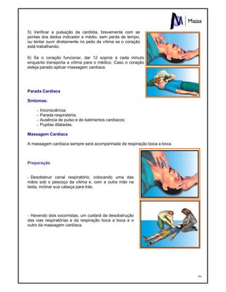 186
5) Verificar a pulsação da carótida, brevemente com as
pontas dos dedos indicador e médio, sem perda de tempo,
ou tentar ouvir diretamente no peito da vítima se o coração
está trabalhando.
6) Se o coração funcionar, dar 12 sopros a cada minuto
enquanto transporta a vítima para o médico. Caso o coração
esteja parado aplicar massagem cardíaca.
Parada Cardíaca
Sintomas:
- Inconsciência;
- Parada respiratória;
- Ausência de pulso e de batimentos cardíacos;
- Pupilas dilatadas.
Massagem Cardíaca
A massagem cardíaca sempre será acompanhada de respiração boca a boca.
Preparação
- Desobstruir canal respiratório, colocando uma das
mãos sob o pescoço da vítima e, com a outra mão na
testa, inclinar sua cabeça para trás.
- Havendo dois socorristas, um cuidará da desobstrução
das vias respiratórias e da respiração boca a boca e o
outro da massagem cardíaca.
 