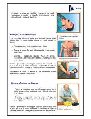 187
- Estando o socorrista sozinho, desobstruir o canal
respiratório e manter a posição improvisando uma
almofada sob o pescoço da vítima.
Massagem Cardíaca em Adultos
Com os braços esticados, apoiar as duas mãos com os dedos
entrelaçados, 2 (dois) dedos acima do osso esterno da
vítima.;
- Fazer vigorosas compressões curtas e fortes;
- Repetir a operação com 60 (sessenta) compressões
por minuto.
- Estando o socorrista sozinho fazer 30 (trinta)
compressões cardíacas para cada 2 (duas) respiração
boca a boca.
Manter o processo de massagem cardíaca e respiração boca
a boca até que a vítima recupere o batimento do coração
(reaparecimento da pulsação) e os movimentos respiratórios.
Encaminhar a vítima a médico e, se necessário manter
atendimento durante o transporte.
Massagem Cardíaca em Crianças
- Após a preparação, com os polegares exercer as 30
(trinta) compressões cardíacas para 2 (duas) respiração
boca a boca;
- Estando o socorrista sozinho fazer 15 (quinze)
compressões cardíacas para cada 2 (duas) respiração
boca a boca;
Manter o processo de massagem cardíaca e respiração boca
a boca até que a vítima recupere o batimento do coração
(reaparecimento da pulsação) e os movimentos respiratórios.
1) Ponto de identificação do
externo
2) Local da massagem
 