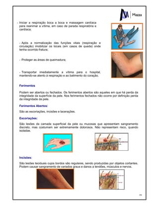 190
- Iniciar a respiração boca a boca e massagem cardíaca
para reanimar a vítima, em caso de parada respiratória e
cardíaca;
- Após a normalização das funções vitais (respiração e
circulação) imobilizar os locais (em casos de queda) onde
tenha ocorrido fratura;
- Proteger as áreas de queimadura;
- Transportar imediatamente a vítima para o hospital,
mantendo-se atento à respiração e ao batimento do coração.
Ferimentos
Podem ser abertos ou fechados. Os ferimentos abertos são aqueles em que há perda da
integridade da superfície da pele. Nos ferimentos fechados não ocorre por definição perda
da integridade da pele.
Ferimentos Abertos:
São as escoriações, incisões e lacerações.
Escoriações:
São lesões da camada superficial da pele ou mucosas que apresentam sangramento
discreto, mas costumam ser extremamente dolorosos. Não representam risco, quando
isoladas.
Incisões:
São lesões teciduais cujos bordos são regulares, sendo produzidas por objetos cortantes.
Podem causar sangramento de variados graus e danos a tendões, músculos e nervos.
 