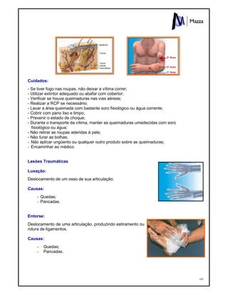 195
Cuidados:
- Se tiver fogo nas roupas, não deixar a vítima correr;
- Utilizar extintor adequado ou abafar com cobertor;
- Verificar se houve queimaduras nas vias aéreas;
- Realizar a RCP se necessário;
- Lavar a área queimada com bastante soro fisiológico ou água corrente;
- Cobrir com pano liso e limpo;
- Prevenir o estado de choque;
- Durante o transporte da vítima, manter as queimaduras umedecidas com soro
fisiológico ou água;
- Não retirar as roupas aderidas à pele;
- Não furar as bolhas;
- Não aplicar ungüento ou qualquer outro produto sobre as queimaduras;
- Encaminhar ao médico.
Lesões Traumáticas
Luxação:
Deslocamento de um osso de sua articulação.
Causas:
- Quedas;
- Pancadas.
Entorse:
Deslocamento de uma articulação, produzindo estiramento ou
rotura de ligamentos.
Causas:
- Quedas;
- Pancadas.
 