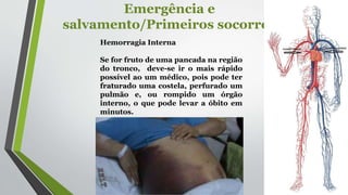 Emergência e
salvamento/Primeiros socorros
Hemorragia Interna
Se for fruto de uma pancada na região
do tronco, deve-se ir o mais rápido
possível ao um médico, pois pode ter
fraturado uma costela, perfurado um
pulmão e, ou rompido um órgão
interno, o que pode levar a óbito em
minutos.
 