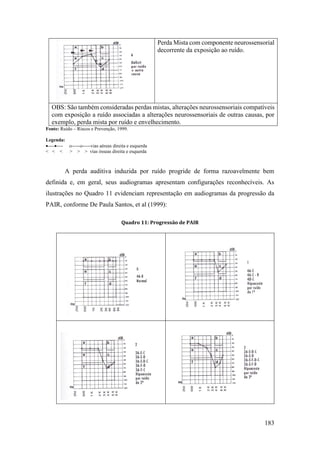 183
Perda Mista com componente neurossensorial
decorrente da exposição ao ruído.
OBS: São também consideradas perdas mistas, alterações neurossensoriais compatíveis
com exposição a ruído associadas a alterações neurossensoriais de outras causas, por
exemplo, perda mista por ruído e envelhecimento.
Fonte: Ruído – Riscos e Prevenção, 1999.
Legenda:
•----•---- ----------vias aéreas direita e esquerda
< < < > > > vias ósseas direita e esquerda
A perda auditiva induzida por ruído progride de forma razoavelmente bem
definida e, em geral, seus audiogramas apresentam configurações reconhecíveis. As
ilustrações no Quadro 11 evidenciam representação em audiogramas da progressão da
PAIR, conforme De Paula Santos, et al (1999):
Quadro 11: Progressão de PAIR
 
