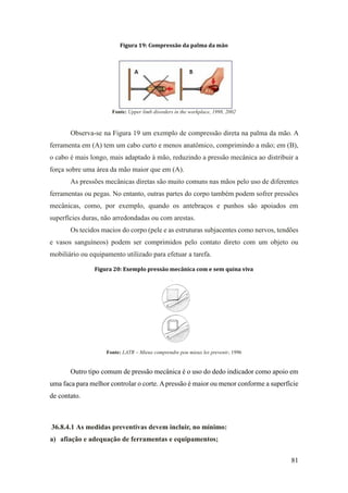 81
Figura 19: Compressão da palma da mão
Fonte: Upper limb disorders in the workplace, 1998, 2002
Observa-se na Figura 19 um exemplo de compressão direta na palma da mão. A
ferramenta em (A) tem um cabo curto e menos anatômico, comprimindo a mão; em (B),
o cabo é mais longo, mais adaptado à mão, reduzindo a pressão mecânica ao distribuir a
força sobre uma área da mão maior que em (A).
As pressões mecânicas diretas são muito comuns nas mãos pelo uso de diferentes
ferramentas ou pegas. No entanto, outras partes do corpo também podem sofrer pressões
mecânicas, como, por exemplo, quando os antebraços e punhos são apoiados em
superfícies duras, não arredondadas ou com arestas.
Os tecidos macios do corpo (pele e as estruturas subjacentes como nervos, tendões
e vasos sanguíneos) podem ser comprimidos pelo contato direto com um objeto ou
mobiliário ou equipamento utilizado para efetuar a tarefa.
Figura 20: Exemplo pressão mecânica com e sem quina viva
Fonte: LATR – Mieux comprendre pou mieux les prevenir, 1996
Outro tipo comum de pressão mecânica é o uso do dedo indicador como apoio em
uma faca para melhor controlar o corte. Apressão é maior ou menor conforme a superfície
de contato.
36.8.4.1 As medidas preventivas devem incluir, no mínimo:
a) afiação e adequação de ferramentas e equipamentos;
 