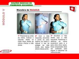 Manobra de Heimlich
1º Posicionar-se atrás
da vítima. Colocar o
cotovelo direito na
crista ilíaca direita da
vítima e fechar a mão
direita
2º Com a mão
esquerda, encontrar
a ponta do osso
esterno da vítima e
colocar a raiz do
polegar da mão
direita dois dedos
abaixo desse ponto.
.
3º Envolver a mão
direita com a mão
esquerda. Pressionar o
abdome da vítima
puxando-o para si e
para cima cinco vezes.
Essa compressão deve
ser suficiente para
erguer o calcanhar da
vítima do solo.
MÓDULOV NOÇÕES BÁSICAS DE
PRIMEIROS SOCORROS
 