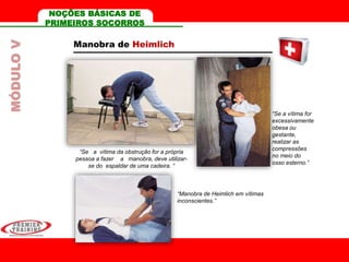 Manobra de Heimlich
“Se a vítima da obstrução for a própria
pessoa a fazer a manobra, deve utilizar-
se do espaldar de uma cadeira. “
“Se a vítima for
excessivamente
obesa ou
gestante,
realizar as
compressões
no meio do
osso esterno.”
“Manobra de Heimlich em vítimas
inconscientes.”
MÓDULOV NOÇÕES BÁSICAS DE
PRIMEIROS SOCORROS
 