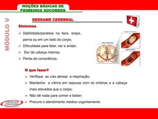 DERRAME CEREBRAL
Sintomas
 Debilidade/paralisia na face, braço,
perna ou em um lado do corpo;
 Dificuldade para falar, ver e andar;
 Dor de cabeça intensa;
 Perda de consciência.
O que fazer?
 Verifique as vias aéreas e respiração;
 Mantenha a vítima em repouso com os ombros e a cabeça
mais elevados que o corpo;
 Não dê nada para comer e beber;
 Procure o atendimento médico urgentemente.
MÓDULOV NOÇÕES BÁSICAS DE
PRIMEIROS SOCORROS
 