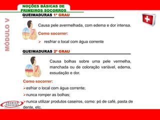 QUEIMADURAS 1º GRAU
Causa pele avermelhada, com edema e dor intensa.
Como socorrer:
 resfriar o local com água corrente
QUEIMADURAS 2º GRAU
Causa bolhas sobre uma pele vermelha,
manchada ou de coloração variável, edema,
exsudação e dor.
Como socorrer:
esfriar o local com água corrente;
nunca romper as bolhas;
nunca utilizar produtos caseiros, como: pó de café, pasta de
dente, etc.
MÓDULOV NOÇÕES BÁSICAS DE
PRIMEIROS SOCORROS
 