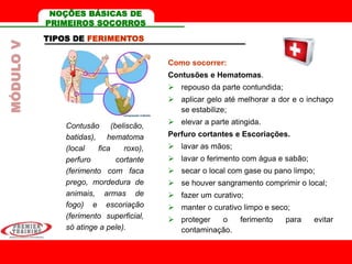 TIPOS DE FERIMENTOS
Contusão (beliscão,
batidas), hematoma
(local fica roxo),
perfuro cortante
(ferimento com faca
prego, mordedura de
animais, armas de
fogo) e escoriação
(ferimento superficial,
só atinge a pele).
Como socorrer:
Contusões e Hematomas.
 repouso da parte contundida;
 aplicar gelo até melhorar a dor e o inchaço
se estabilize;
 elevar a parte atingida.
Perfuro cortantes e Escoriações.
 lavar as mãos;
 lavar o ferimento com água e sabão;
 secar o local com gase ou pano limpo;
 se houver sangramento comprimir o local;
 fazer um curativo;
 manter o curativo limpo e seco;
 proteger o ferimento para evitar
contaminação.
MÓDULOV NOÇÕES BÁSICAS DE
PRIMEIROS SOCORROS
 
